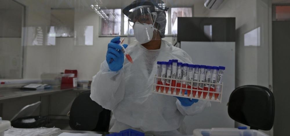 Anvisa autoriza retomada de testes da CoronaVac