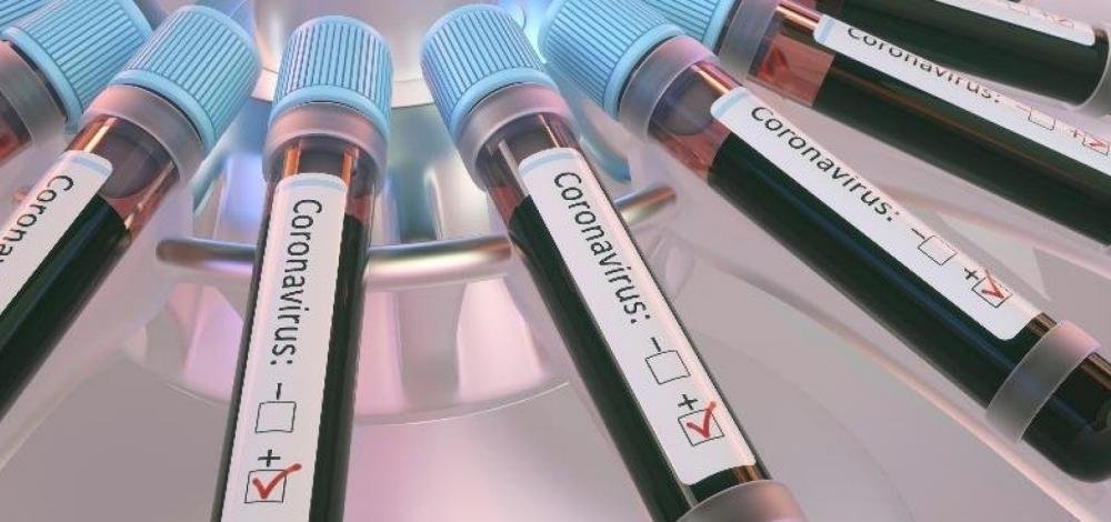 Brasil registra 173.979 mortes por Covid-19, diz consórcio de imprensa