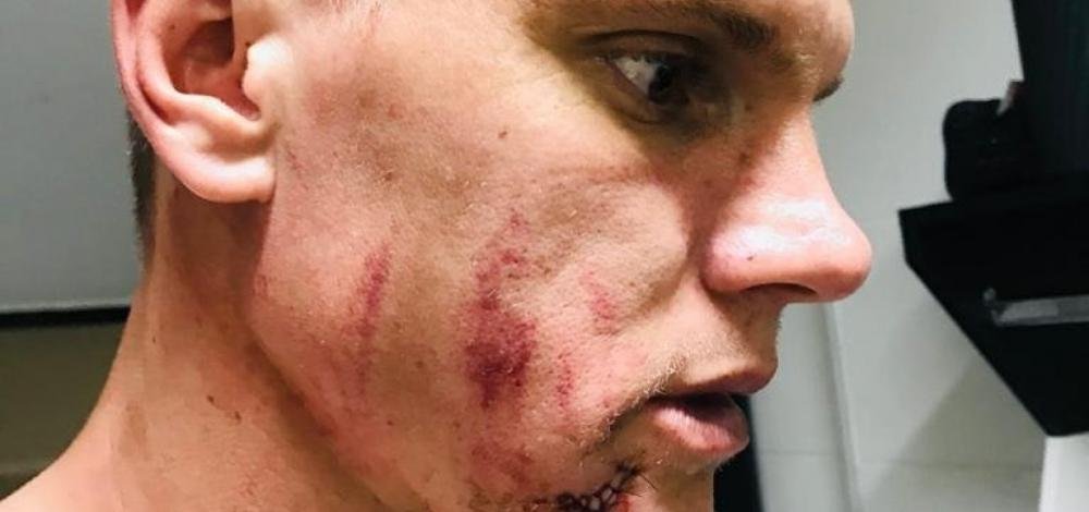 Goleiro do Bahia leva cinco pontos no rosto após choque com zagueiro do Vasco