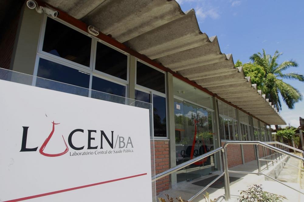 Lacen divulga análise genética de 32 amostras de coronavírus nesta sexta